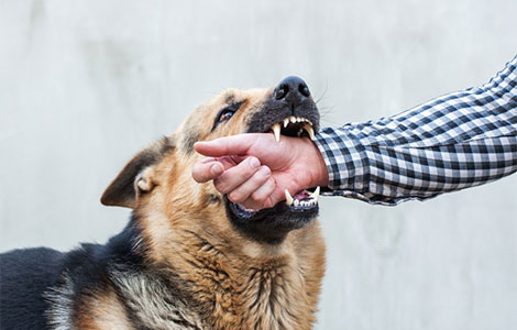 Dog-Owners-Can-Face-Serious-Legal-Repercussions-If-Their-Dog-Bites-Someone